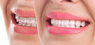 Kraska Center for Cosmetic and General Dentistry | Dental Fillings, Night Guards and Implant Dentistry